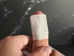 T-tape applied to erect penis.